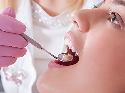 Van Cortlandt Dental Care | Dental Fillings, Crowns  amp  Caps and Root Canals